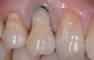 牙疼之谜：东西方医学揭秘牙疼的多元原因