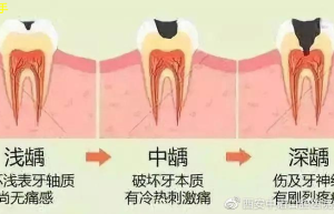 揭秘：牙疼新趋势！疼痛位置暗示何种疾病？