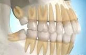 牙疼的症状解析：疼痛背后的原因及应对方法