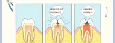 牙疼新知了解牙齿敏感的秘密