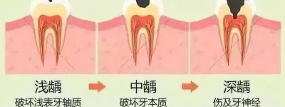 揭秘：牙疼新趋势！疼痛位置暗示何种疾病？