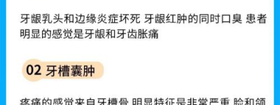 最近最热门的牙疼症状解析如何识别牙根裂解？